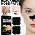 Nose Black Head Remover Strips
